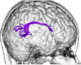 Symptoms centerright.brain