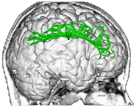 Coma Help for Families topleft.brain